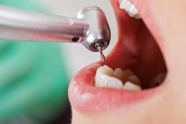 Best Urgent Care for Lost Fillings or Crowns in Hugo, OK